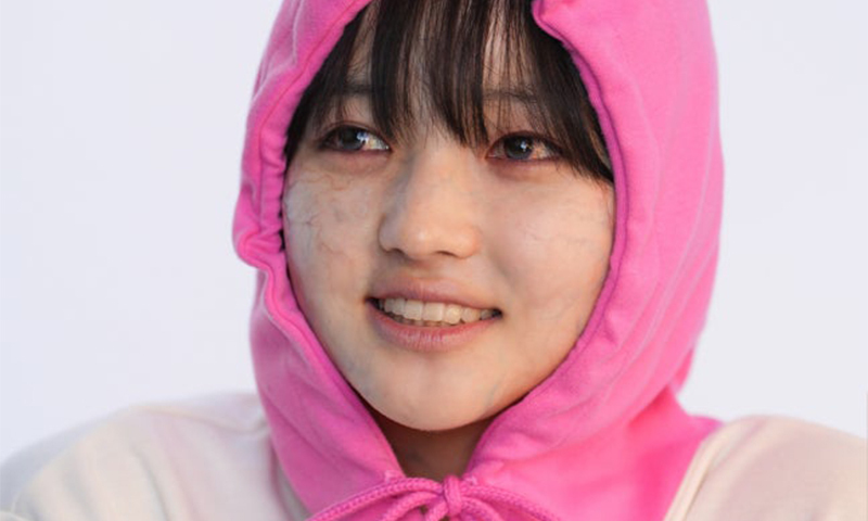 ‘좀비딸’ 최유리, 특수 분장도 러블리하게